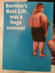 Huge butt lift success!