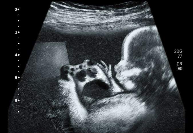 Expecting a gamer
