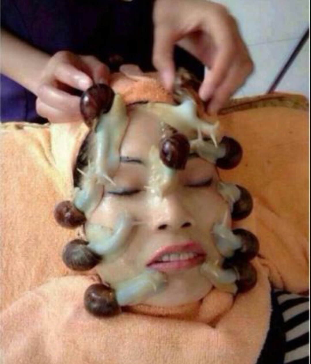 Snail beauty procedures