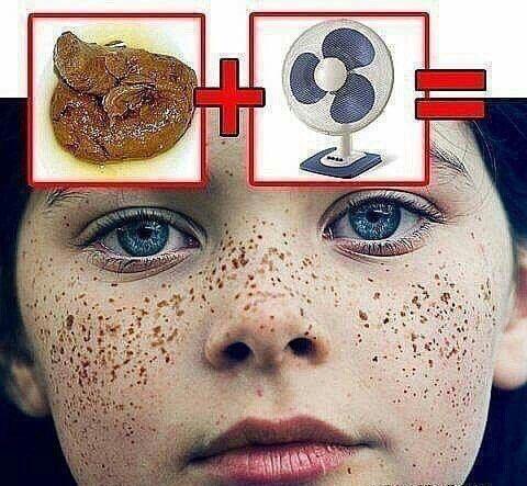 How to get freckles
