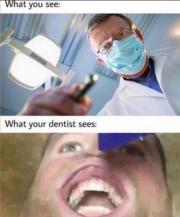 What you see vs what your dentist sees