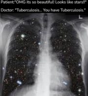 You have tuberculosis
